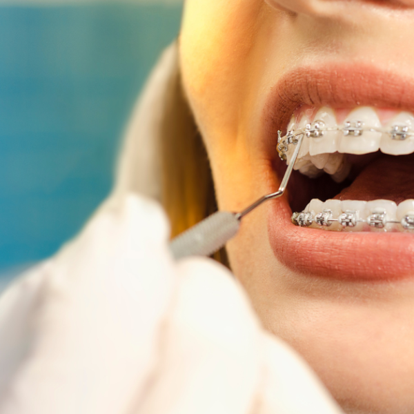 Transform Your Smile With Stellar Orthodontic:Excellence In Orthodontic Care For Your Perfect Smile   