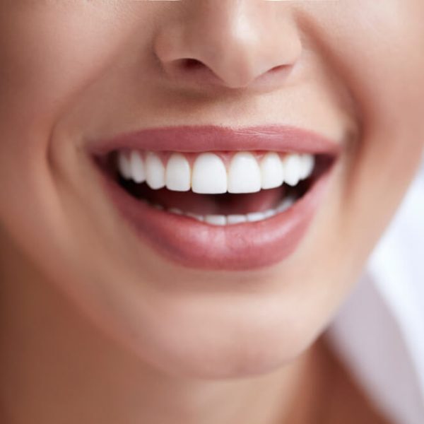 Expert Tooth Colored Restorations In Evanston, IL:Achieve A Natural-Looking, Beautiful Smile