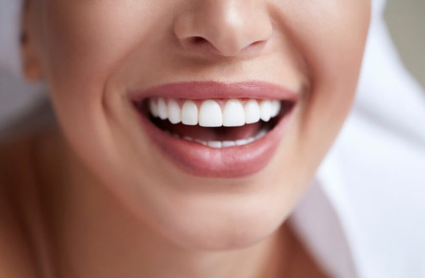 Expert Tooth Colored Restorations In Evanston, IL:Achieve A Natural-Looking, Beautiful Smile